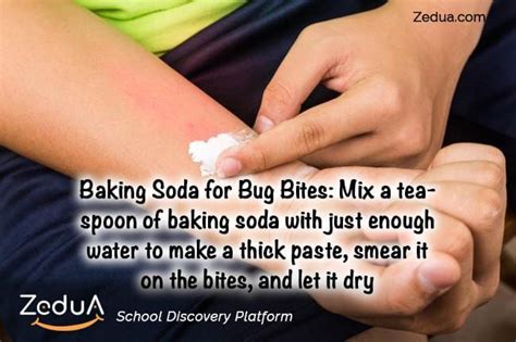 Baking Soda For Bug Bites Health Parenting Tips Baking