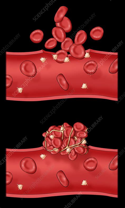 Blood Clot Stock Image C0306736 Science Photo Library