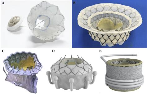 Transcatheter Mitral Valve Replacement Journal Of Cardiology