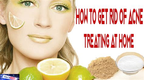 How To Get Rid Of Acne Treating At Home Youtube