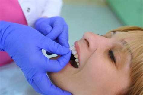 Instant Orthodontics With Veneers Veneers Petaluma Dr Bob Koenitzer