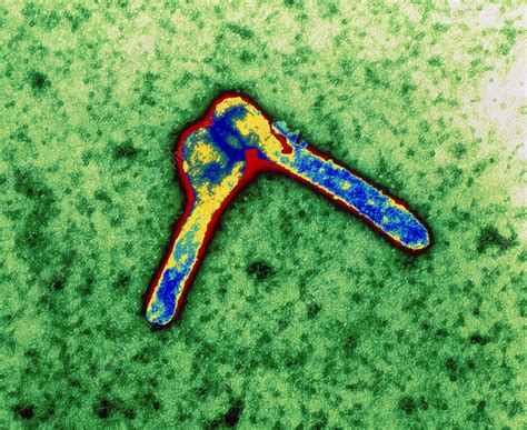 The world health organization (who) rates it as a risk group 4 pathogen. Coloured TEM of two Marburg viruses - Stock Image M050/0572 - Science Photo Library