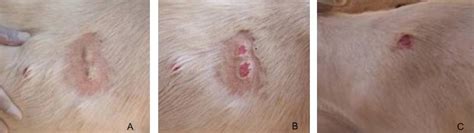Different Size Rounded Raised Scaling And Crusting Skin Lesions A