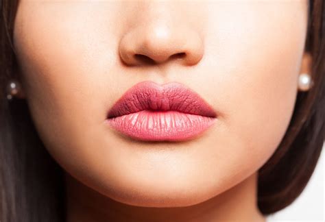 10 coisas que você deve saber antes de realizar o preenchimento labial