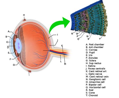 Retinal Detachment Article