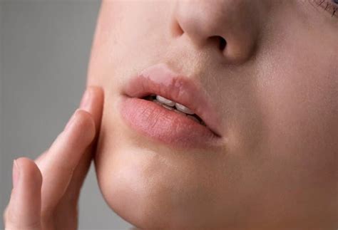How To Heal Cracked Lip Corners Fast Rapid Relief Methods Vitamin