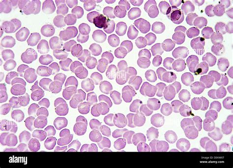 Human Blood Smear Anucleated Erythrocytes Red Blood Cells1000 X