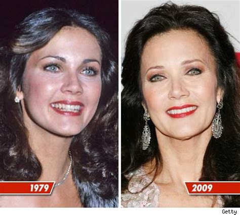 Lynda Carter Plastic Surgery Before And After Photos