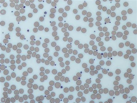 Basic Understanding Of Platelets Cambium Medical Technologies