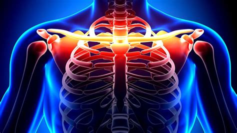 Clavicle Fracture Collarbone Injuries Injury Injury Choices