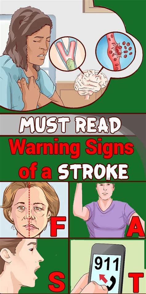 7 Early Warning Signs Of Stroke Everyone Should Know Health And