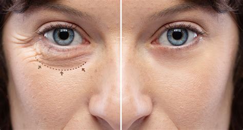 Here are a couple reasons How to Make Your Eyes Look Smaller - With & Without Makeup