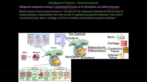 112p Nomenclature Of Benign And Malignant Cancers How To Name