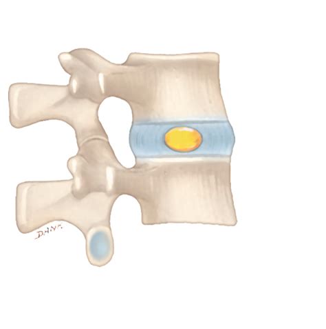 Figure 920 Intervertebral Discs A Right Lateral View Of Articulated