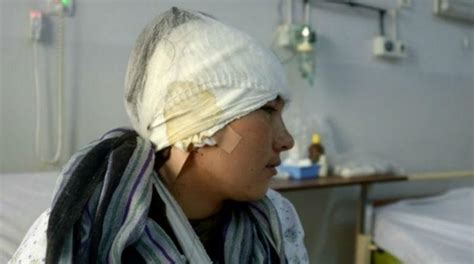 Afghan Woman Whose Husband Cut Off Her Ears Seeks Treatment Abroad