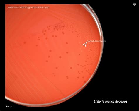Listeria Monocytogenes Hemolysis On Blood Agar Plate Beta Hemolytic