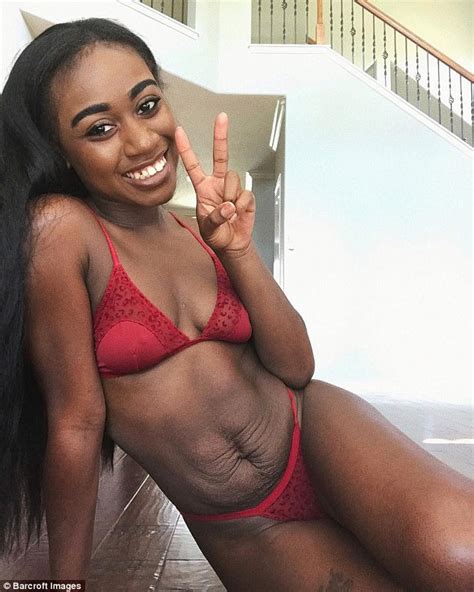 Texas Mother Shows Off Stretch Marks In Lingerie Shoot Express Digest