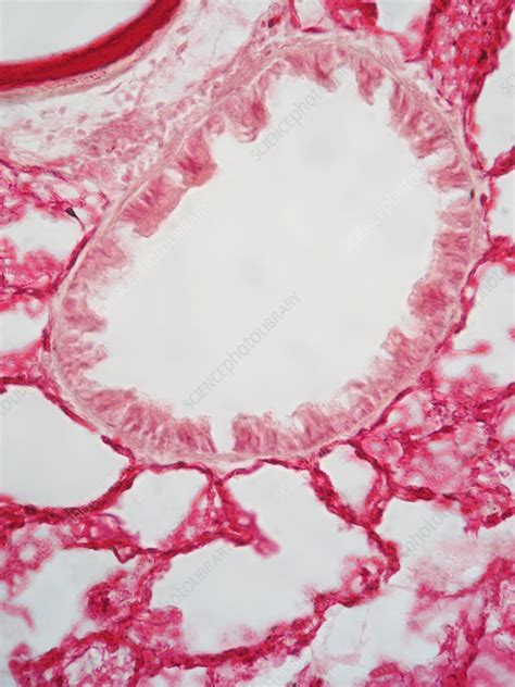 Lm Of Lung Bronchiole Stock Image C0174188 Science Photo Library