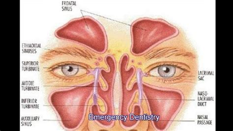 Emergency Dentistry Dealing With A Sinus Infection