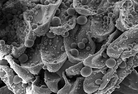 What Are Some Of The Best Electron Microscope Photos Quora