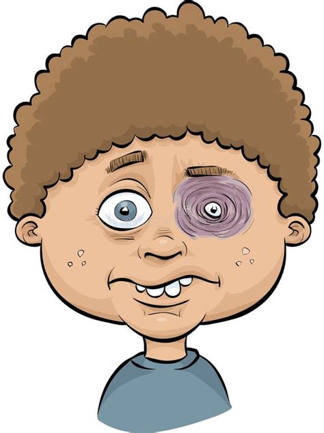 Boy With Black Eye Stock Illustration Illustration Of Child 41194928