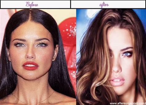 Adriana Lima Before After Plastic Surgery