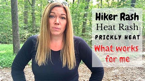 Hiker Rash Heat Rash What Worked For Me Prevention And Treatment
