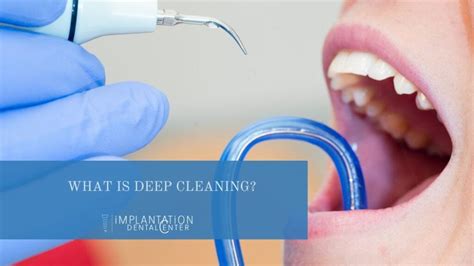 Dental Deep Cleaning · Scaling And Root Planing