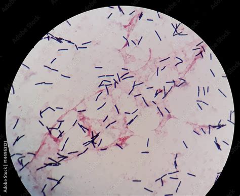 Smear Of Human Blood Culture Grams Stained With Gram Positive Bacilli