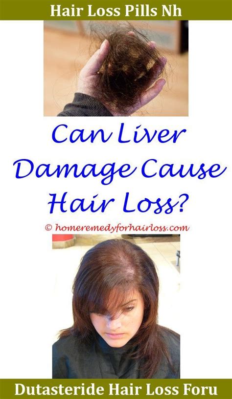 Some other medications prescribed for bipolar disorder also may cause thinning hair (alopecia). Lamotrigine Side Effects Hair Loss