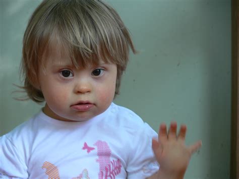 Nie tylko dlatego, że nieuleczalne. Zdrowie :: nataliasznitko