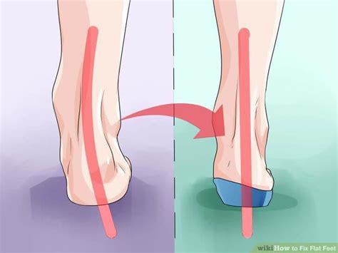Use of insoles to treat flat feet. Best Insoles for Flat Feet Fully Reviewed in 2018 ...