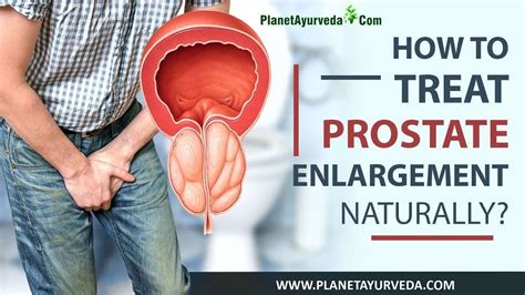 How To Treat Enlarged Prostate Brittany Roy S Blog