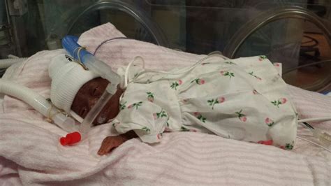 North Carolina Hospital Celebrates One Of The Worlds Smallest Babies