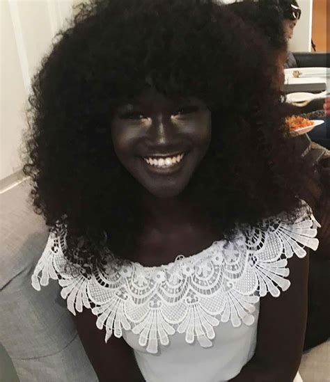 Teen Bullied For Her Incredibly Dark Skin Color Becomes A Model Takes The Internet By Storm