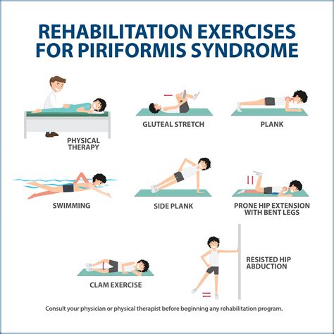 Piriformis Syndrome Rehabilitation Exercises Infographic