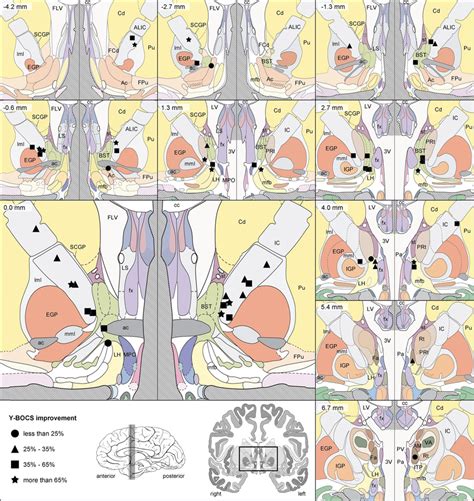 The coronal plane (frontal plane) slices the body into two halves, namely the front side and backside. Coronal brain atlas slices showing the location of the ...