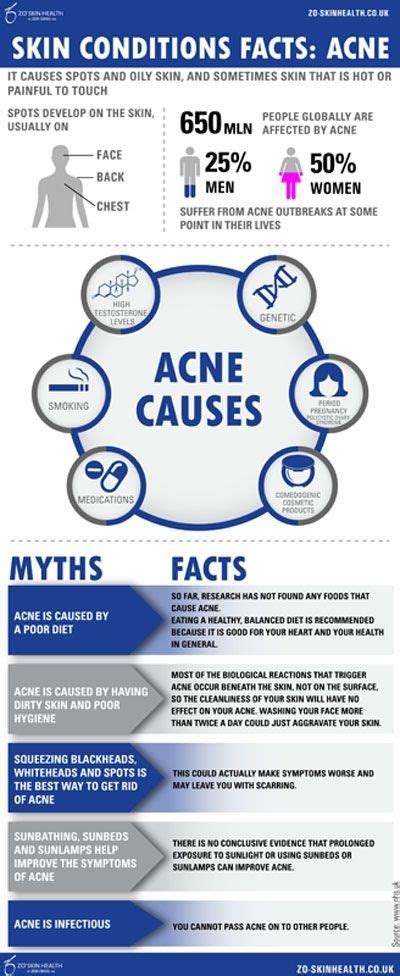 Skin Condition Facts Acne Infographics Overnightacnebeautytips