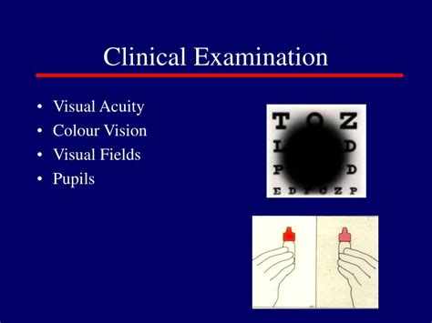 Ppt Neuro Ophthalmology Powerpoint Presentation Free Download Id