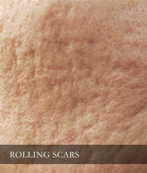 Rolling Scar Dr