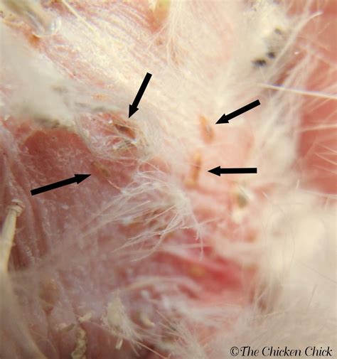 Poultry Lice And Mites Identification And Treatment The Chicken Chick®