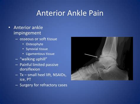 Ppt Chronic Ankle Pain Powerpoint Presentation Free Download Id