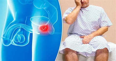 Although early stage symptoms are harder to detect, there are a number of warning signs that could potentially indicate you're at risk for prostate cancer or have already developed it. 10 warning signs of prostate cancer - Daily Star
