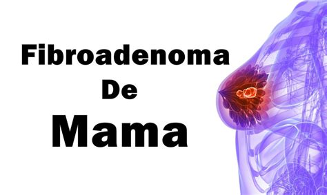 Os Principais Sintomas do Fibroadenoma da Mama Dicas de Saúde