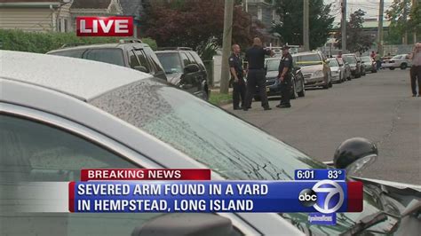 Severed Arm Found In Front Yard Of Hempstead Long Island Home