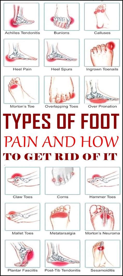 Outside Foot Pain Chart