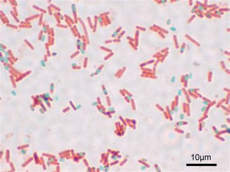 Staphylococcus Aureus Endospore Stain