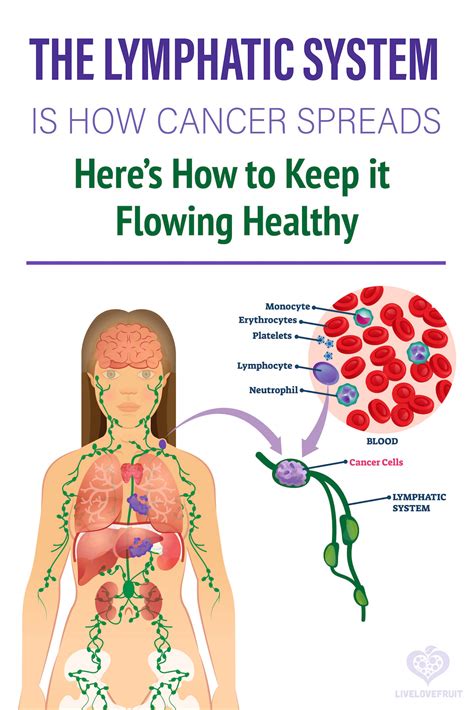 The Lymphatic System Is How Cancer Spreads Here Are 10 Ways To Keep