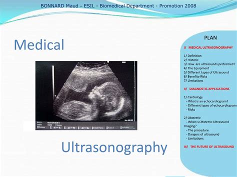 Ppt Medical Ultrasonography Powerpoint Presentation Free Download