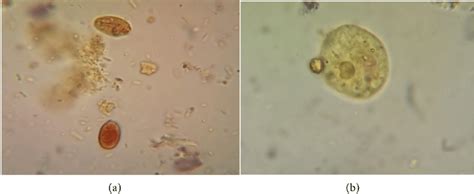 A Trophozoite Of The Parasites Giardia Lamblia And B Entymoeba